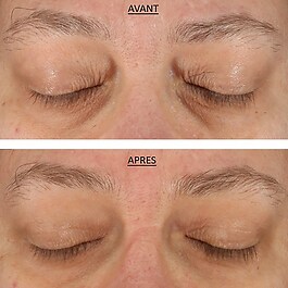 FAB-Skin Lab Retinol & Hyaluronic Acid Eye Cream